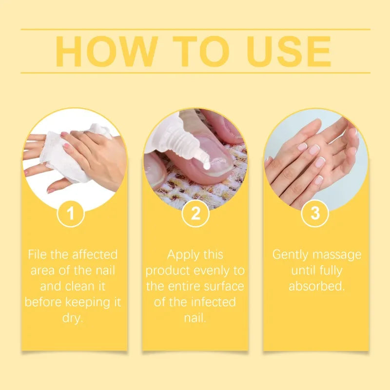 Bee Venom Nail Fungus Solution Hand Foot Care Toenail Thickening Yellowing Essence Ingrown Nail Gray Bright Nail Repair Product