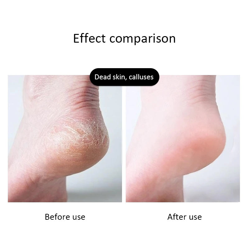 1Pc Professional Foot Scraper Stainless Steel Foot Care Pedicure Scraper Remove Dead Skin Portable Nail Clipper Exfoliating Tool