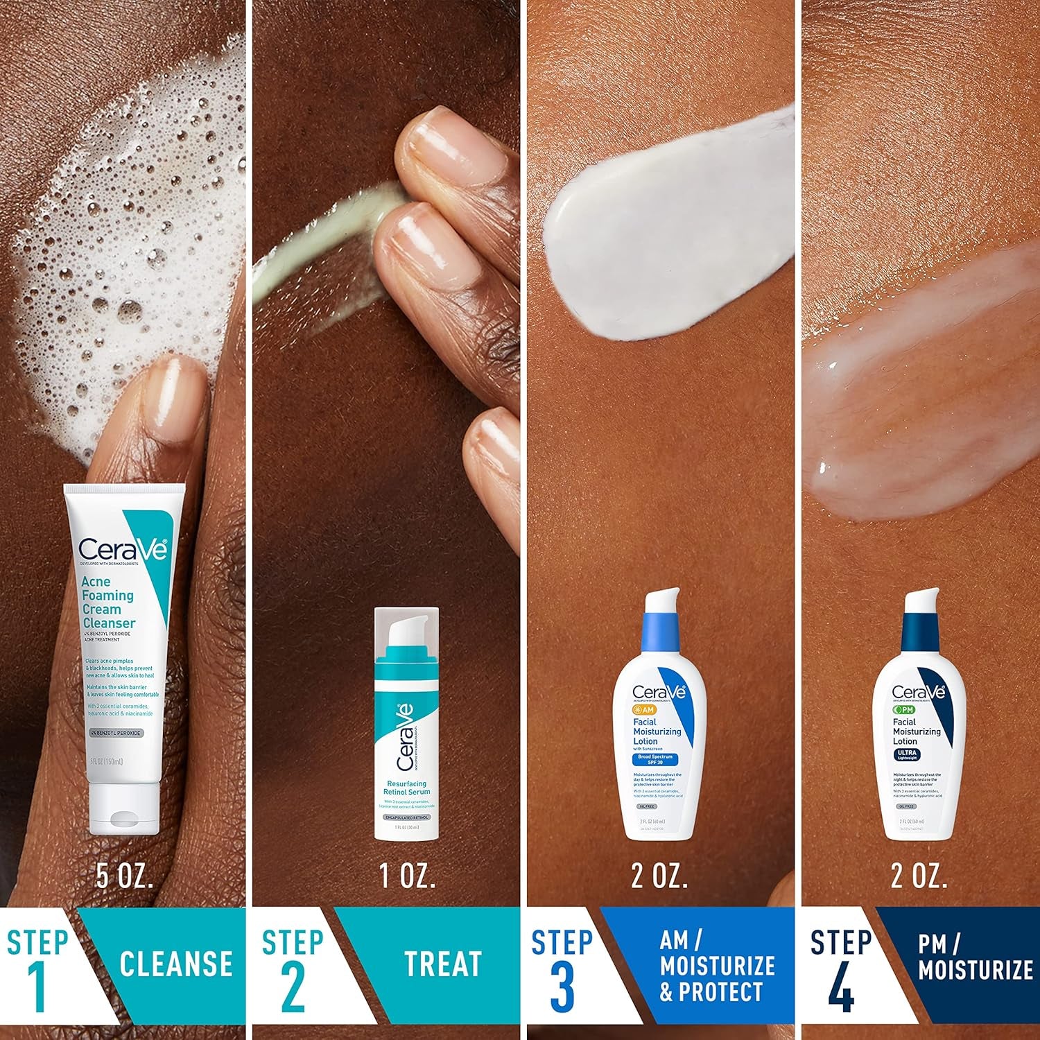 CeraVe Comprehensive Acne Skin Care Set: Foaming Cream Cleanser (5 oz), Resurfacing Retinol Serum (1 oz), AM Facial Moisturizing Lotion with SPF 30 (2 oz), PM Facial Moisturizing Lotion (2 oz)