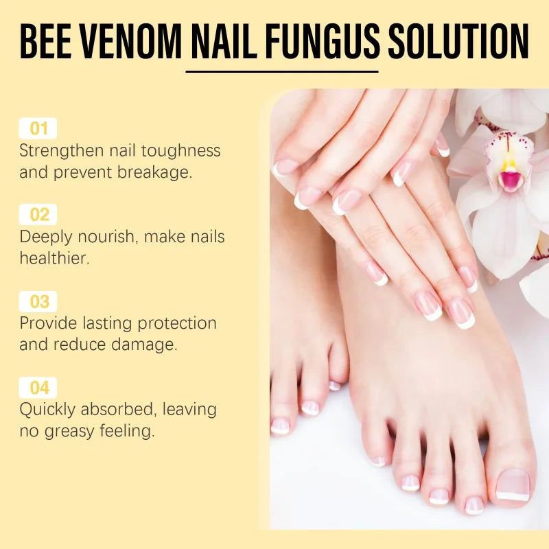 Bee Venom Nail Fungus Solution Hand Foot Care Toenail Thickening Yellowing Essence Ingrown Nail Gray Bright Nail Repair Product