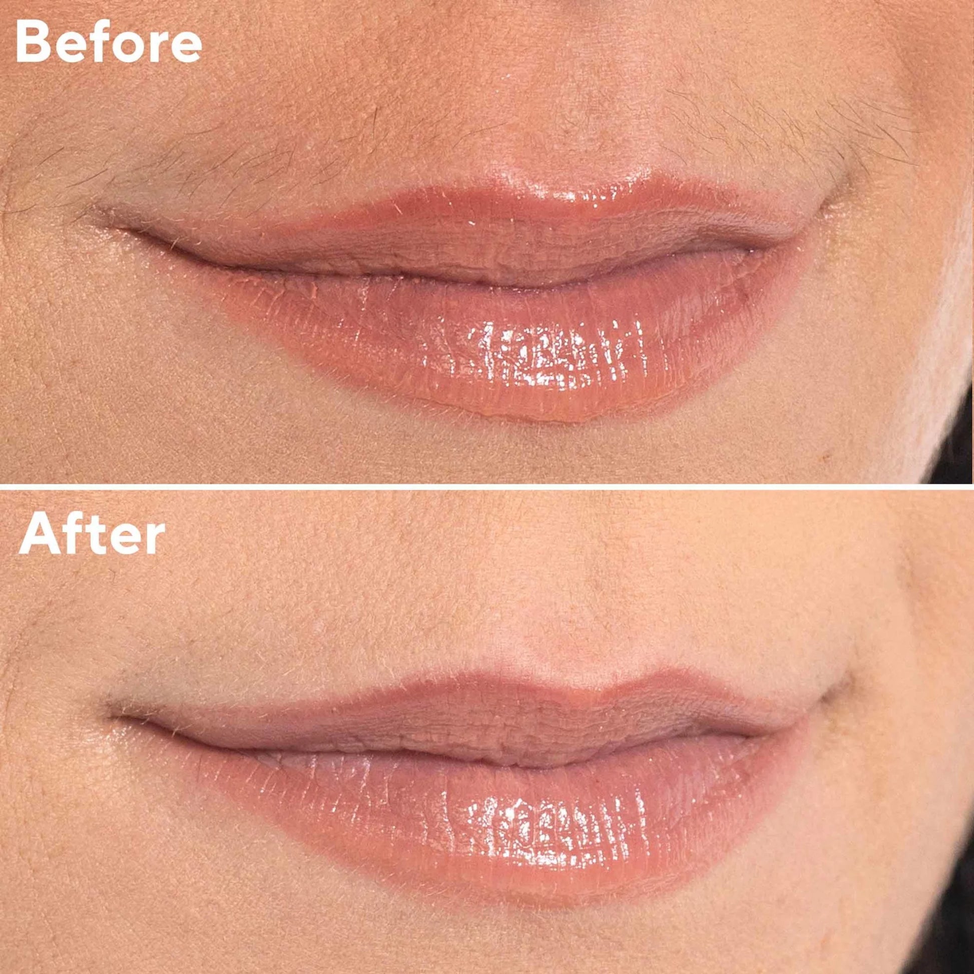 Finishing Touch Facial Hair Remover for Women, Rose Gold