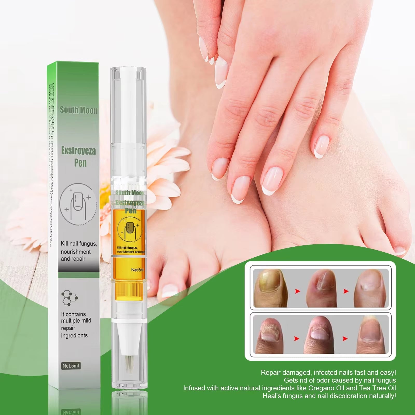 Nail Fungus Repair Pen Remove Onychomycosis Paronychia Reduce Toe Infection Brighten Nail Hand Foot Nail Care Liquid